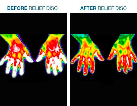 Body Align Pain Relief patches showing before and after of hands pain relief.