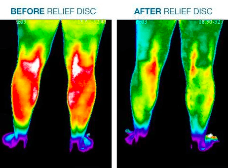 Body Align Pain Relief patches showing before and after of leg pain relief.